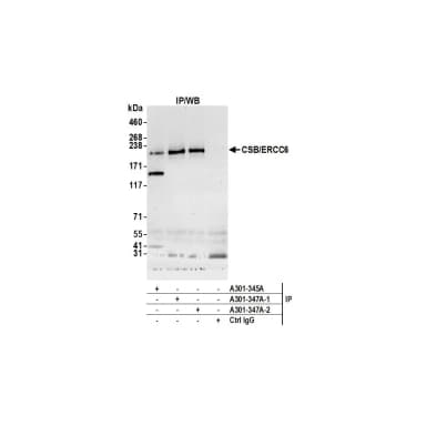 Rabbit anti-CSB/ERCC6 Antibody, Affinity Purified