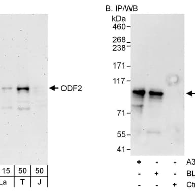 Rabbit anti-ODF2 Antibody, Affinity Purified