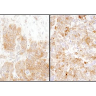 Rabbit anti-TS Antibody, Affinity Purified
