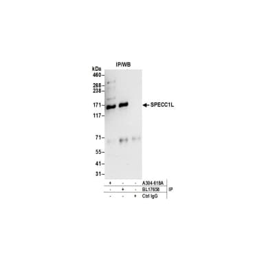 Rabbit anti-SPECC1L Antibody, Affinity Purified