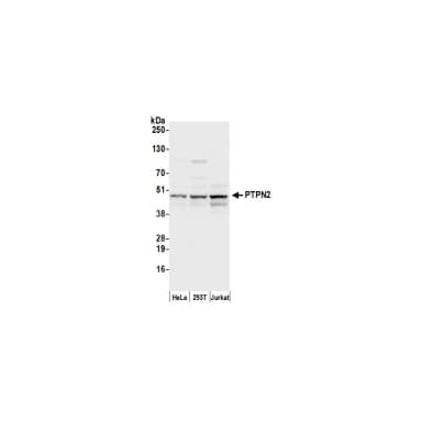 Rabbit anti-PTPN2/TCPTP Antibody, Affinity Purified