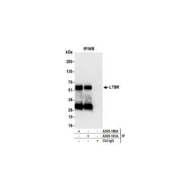 Rabbit anti-LTBR/Lymphotoxin-beta Receptor Antibody, Affinity Purified