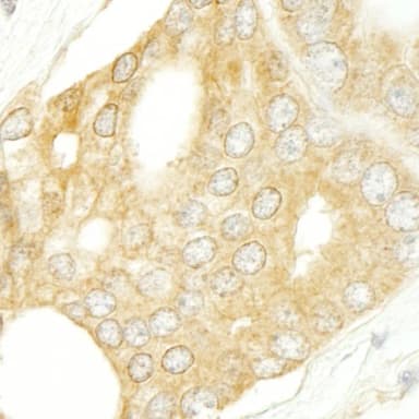 Rabbit anti-BRAF IHC Antibody, Affinity Purified