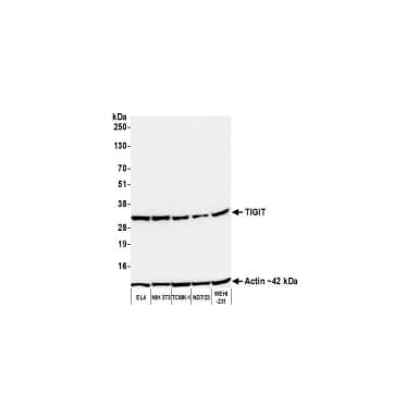 Goat anti-Chicken IgG (IgY) Heavy and Light Chain Antibody DyLight® 594 Conjugated