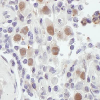 Rabbit anti-MSH6 Antibody, Affinity Purified