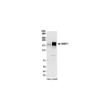 Rabbit anti-DNMT1 Antibody, Affinity Purified