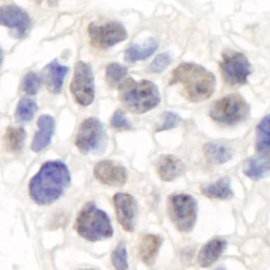 Rabbit anti-Artemis Antibody, Affinity Purified