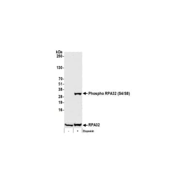 Rabbit anti-Phospho RPA32 (S4/S8) Antibody, Affinity Purified