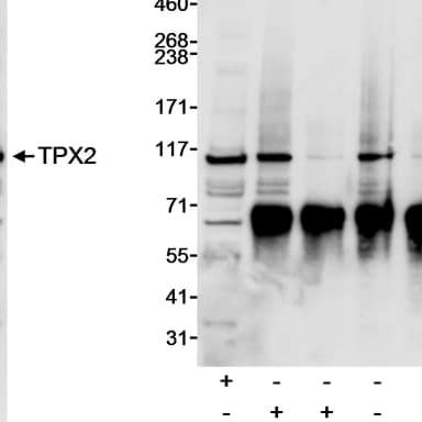 Rabbit anti-TPX2 Antibody, Affinity Purified