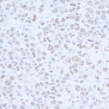 Rabbit anti-EDD1 Antibody, Affinity Purified