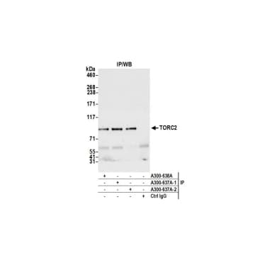 Rabbit anti-TORC2 Antibody, Affinity Purified
