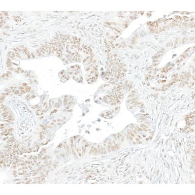 Rabbit anti-Phospho RNA Polymerase II (S2) Antibody, Affinity Purified
