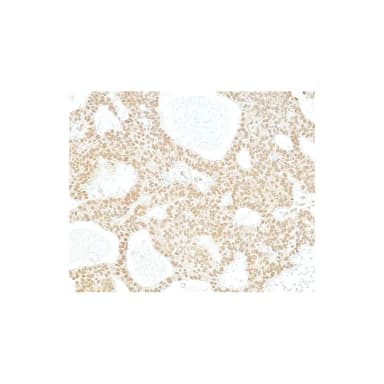 Rabbit anti-HDAC2 Antibody, Affinity Purified