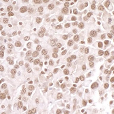 Rabbit anti-PRMT1 Antibody, Affinity Purified