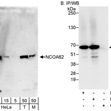 Rabbit anti-NCOA62 Antibody, Affinity Purified
