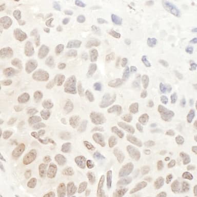 Rabbit anti-DHX33 Antibody, Affinity Purified