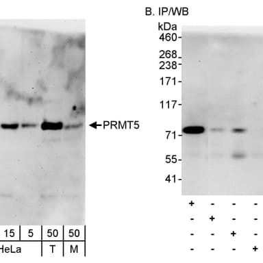 Rabbit anti-PRMT5 Antibody, Affinity Purified