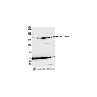 Rabbit anti-Topo II Beta Antibody, Affinity Purified