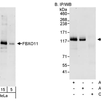 Rabbit anti-FBXO11 Antibody, Affinity Purified