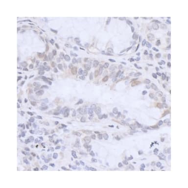 Rabbit anti-HMGN3 Antibody, Affinity Purified
