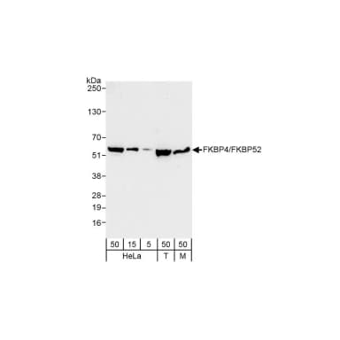 Rabbit anti-FKBP4/FKBP52 Antibody, Affinity Purified
