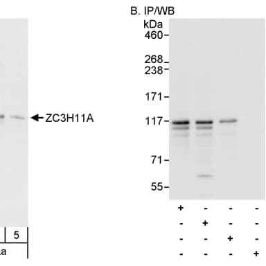 Rabbit anti-ZC3H11A Antibody, Affinity Purified