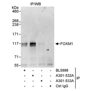 Rabbit anti-FOXM1 Antibody, Affinity Purified