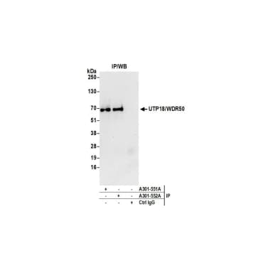 Rabbit anti-UTP18/WDR50 Antibody, Affinity Purified