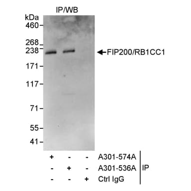 Rabbit anti-FIP200/RB1CC1 Antibody, Affinity Purified