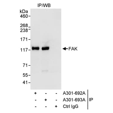 Rabbit anti-FAK Antibody, Affinity Purified
