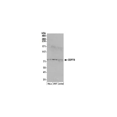 Rabbit anti-CEP78 Antibody, Affinity Purified