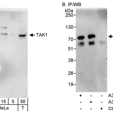 Rabbit anti-TAK1 Antibody, Affinity Purified