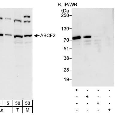 Rabbit anti-ABCF2 Antibody, Affinity Purified