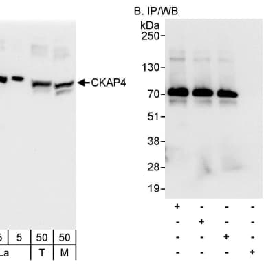 Rabbit anti-CKAP4 Antibody, Affinity Purified