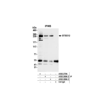 Rabbit anti-BTBD12 Antibody, Affinity Purified