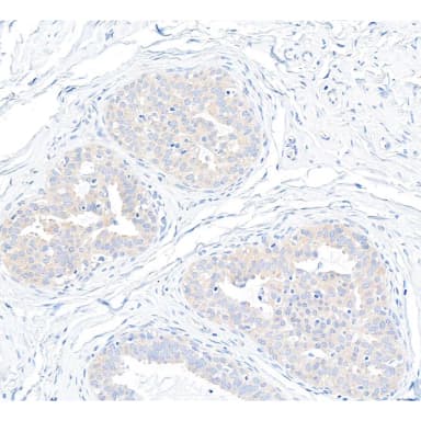 Rabbit anti-p600 Antibody, Affinity Purified