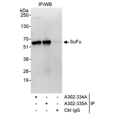 Rabbit anti-SuFu Antibody, Affinity Purified