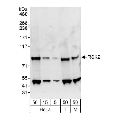 Rabbit anti-RSK2 Antibody, Affinity Purified