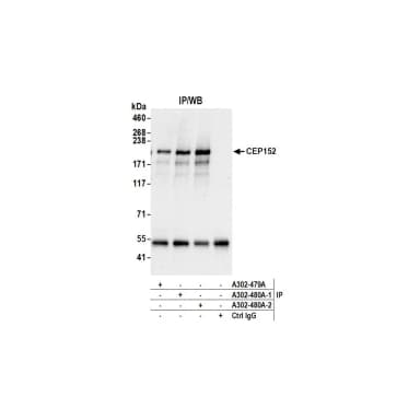 Rabbit anti-CEP152 Antibody, Affinity Purified