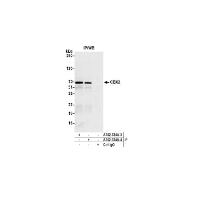 Rabbit anti-CBX2 Antibody, Affinity Purified