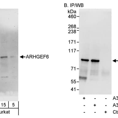 Rabbit anti-ARHGEF6 Antibody, Affinity Purified