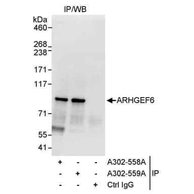 Rabbit anti-ARHGEF6 Antibody, Affinity Purified