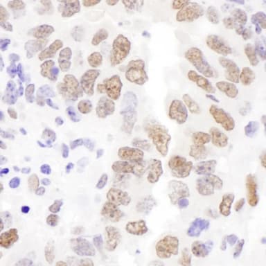 Rabbit anti-HEXIM1 Antibody, Affinity Purified