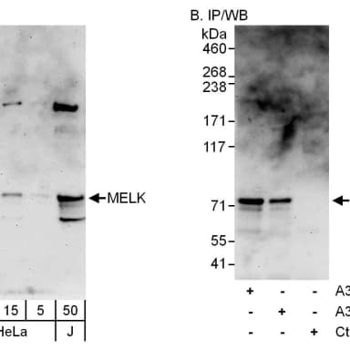 Rabbit anti-MELK Antibody, Affinity Purified