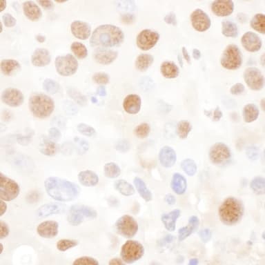 Rabbit anti-NF45 Antibody, Affinity Purified