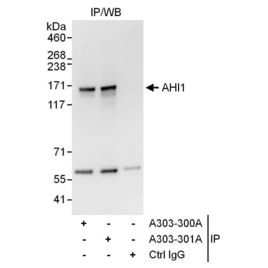 Rabbit anti-AHI1 Antibody, Affinity Purified