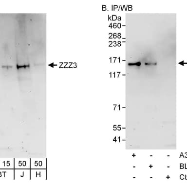 Rabbit anti-ZZZ3 Antibody, Affinity Purified