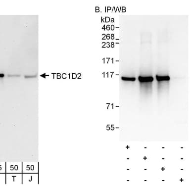 Rabbit anti-TBC1D2 Antibody, Affinity Purified