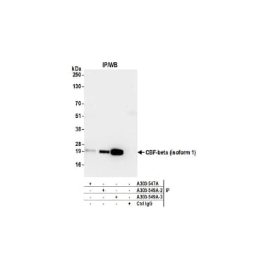 Rabbit anti-CBF-beta (isoform 1) Antibody, Affinity Purified