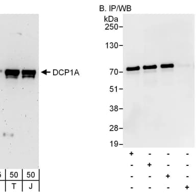 Rabbit anti-DCP1A Antibody, Affinity Purified